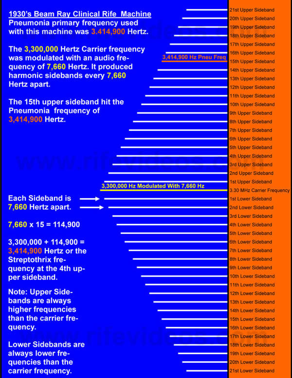 Pneumonia Sideband Chart